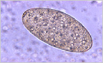 akkoshkiy-parasite
